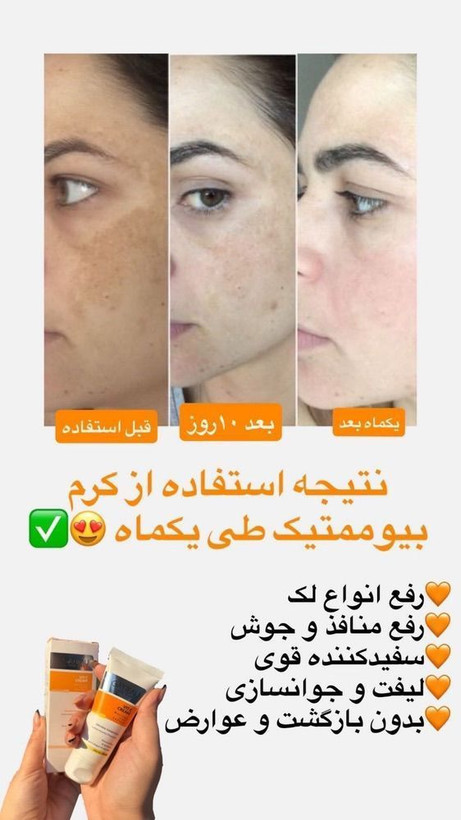 کرم بیومیمتیک ویتامین C گاتیو | روشنکننده و ضد لک پوست